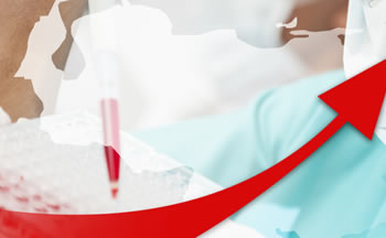 Indice de VIH en Venezuela